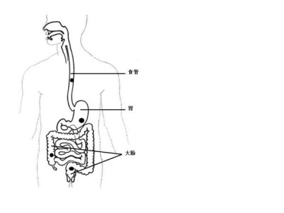 如何早期发现消化道肿瘤  235乘以115100_400x300.jpg