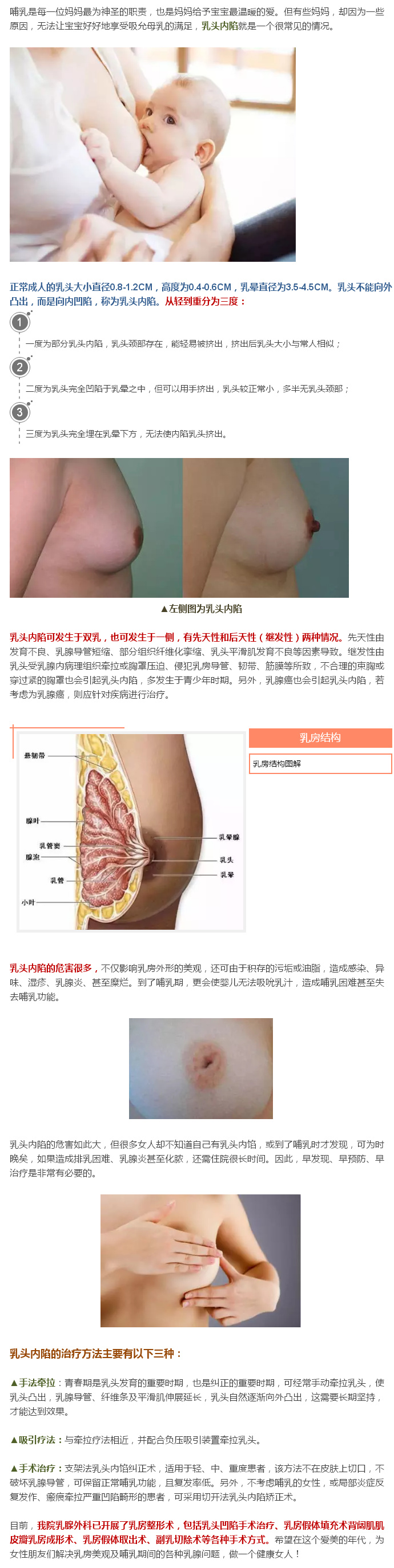 乳头内陷的危害与治疗.jpg