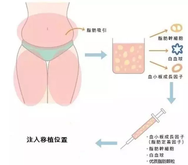 QQ图片20180423173910.jpg QQ图片20180423173910.jpg