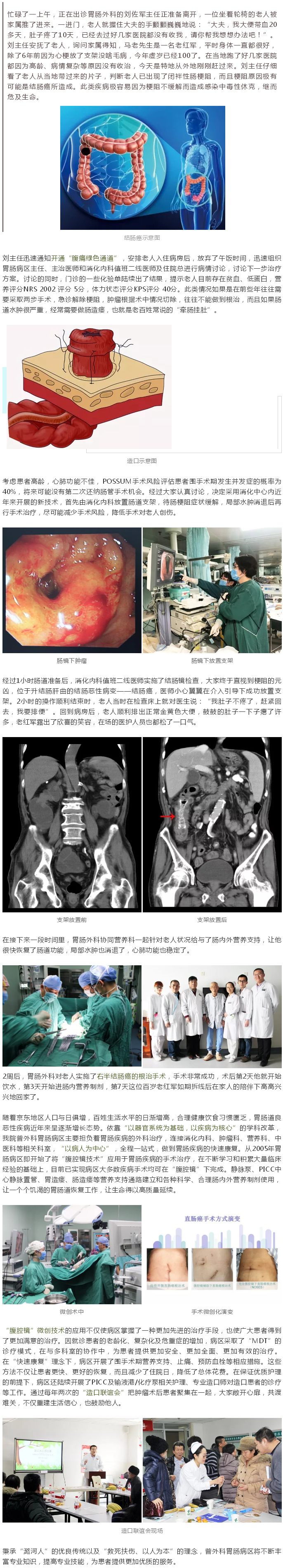 百岁老红军 不用“牵肠挂肚”——我院采用全程一站式、快速康复技术治疗胃肠疾病.jpg