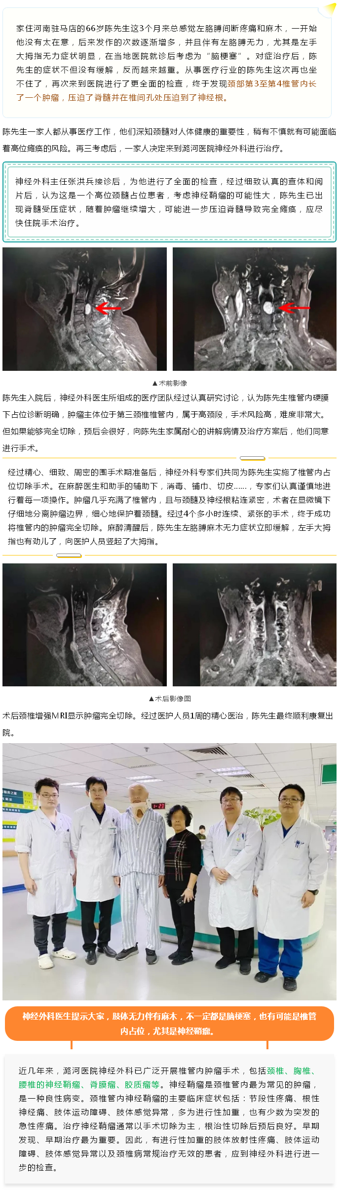 手臂麻木、无力就一定是脑梗塞吗？——要警惕神经鞘瘤在作祟.jpg