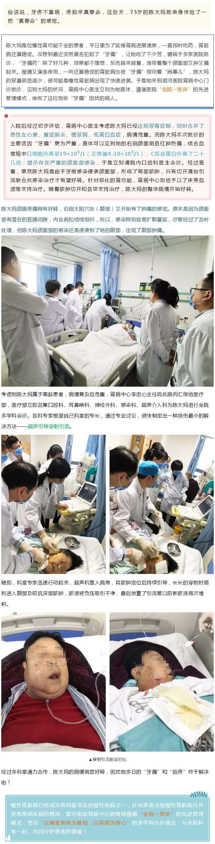 兄弟齐心 其力断金 ——潞河医院多学科合作成功救治一名尿毒症伴颌面部脓肿患者.jpg