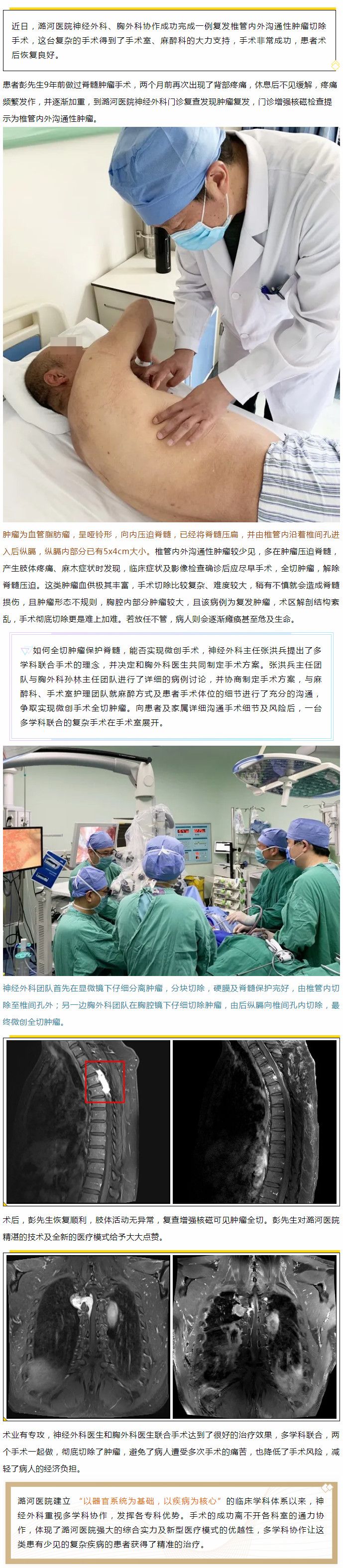 潞河医院成功完成 一例复发椎管内外沟通性肿瘤切除手术.jpg
