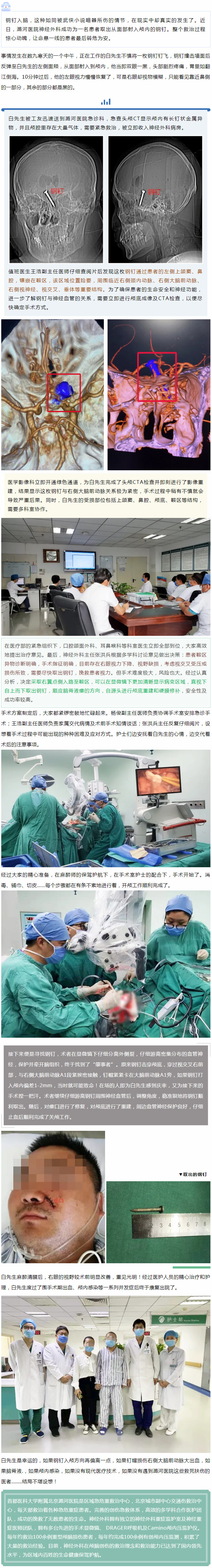 2021-01-11 钢钉入脑 幸遇良医 —— 潞河医院神经外科抢救钢钉入脑患者的真实故事.jpg
