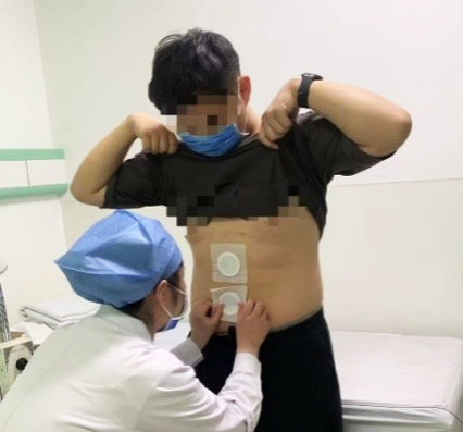 外治法:贴敷治疗