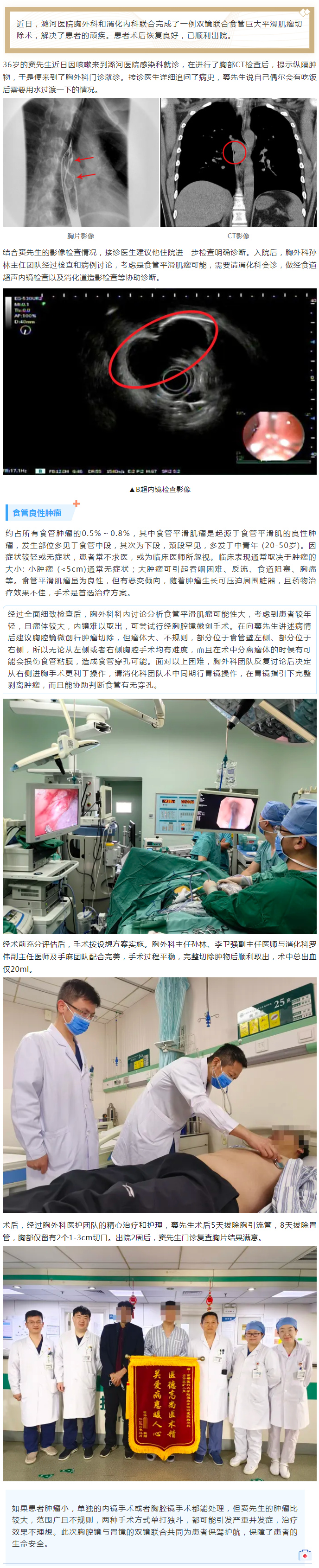 “双镜联合” 治疗食管巨大平滑肌瘤.jpg