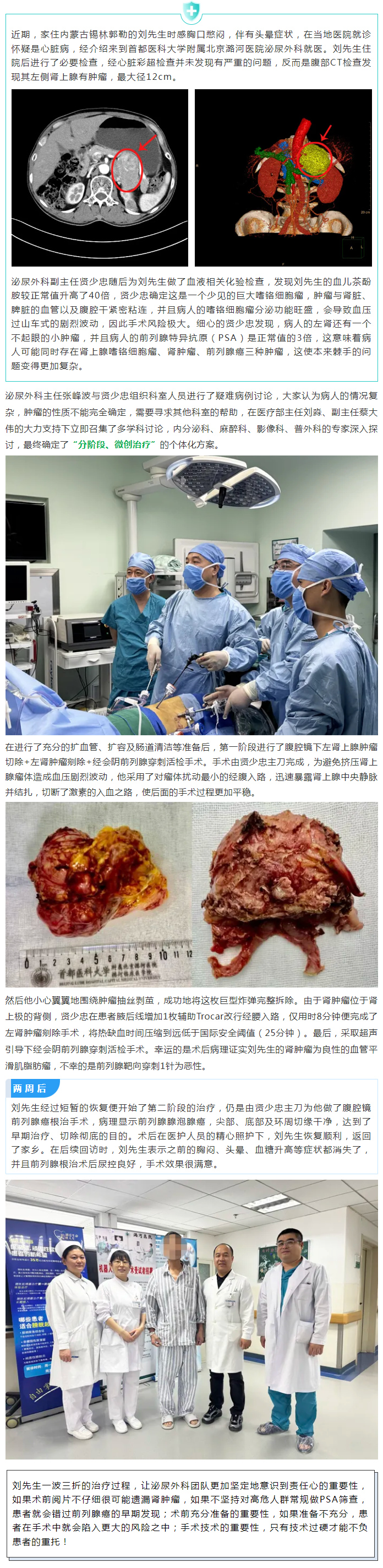 520一箭三雕展现潞河实力 专业精细不负患者重托——潞河医院成功救治一位巨大嗜铬细胞瘤合并肾肿瘤、前列腺癌的患者.jpg