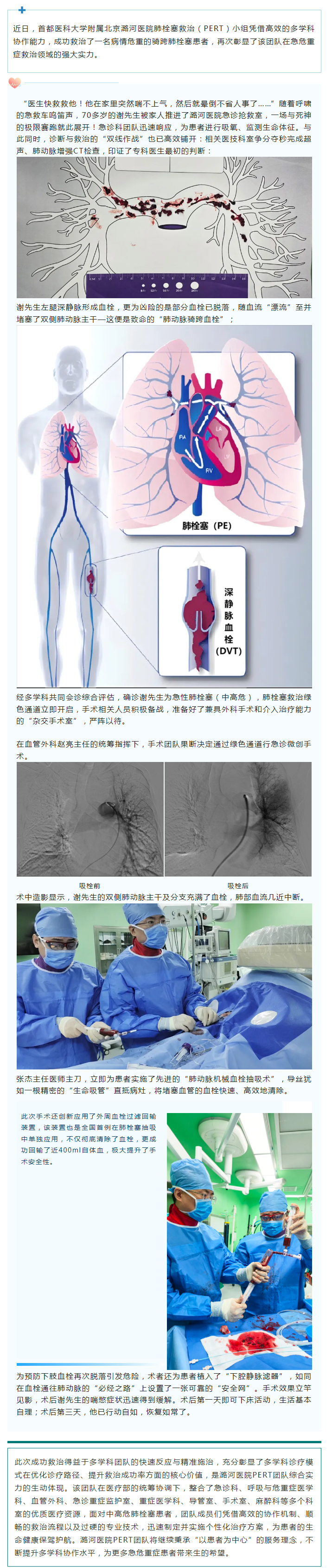 七旬老人突发晕厥命悬一线 微创手术吸出“肺梗”化险为夷.jpg